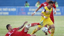 Bảo hiểm đôi chân cho cầu thủ Việt: Tín hiệu đáng mừng